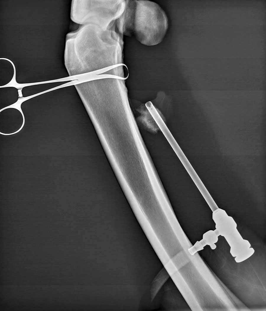 Understanding the physeal spike complex in equine athletes
