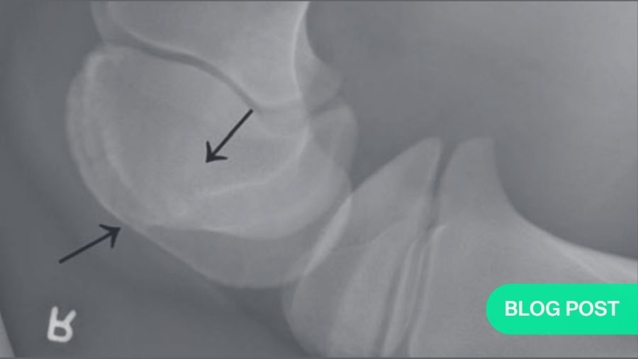 Comprehensive patellar luxation in humans, horses, and dogs