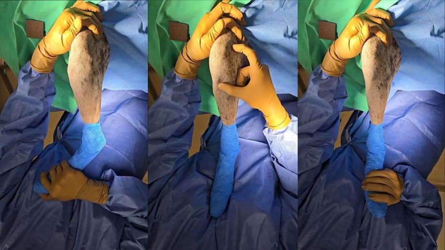 Examination for lateral suture stabilization to TPLO in dogs with severe rotational instability